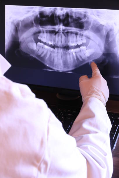 Best Emergency Treatment for Dental Infections or Abscesses in Rshfield Hills, MA